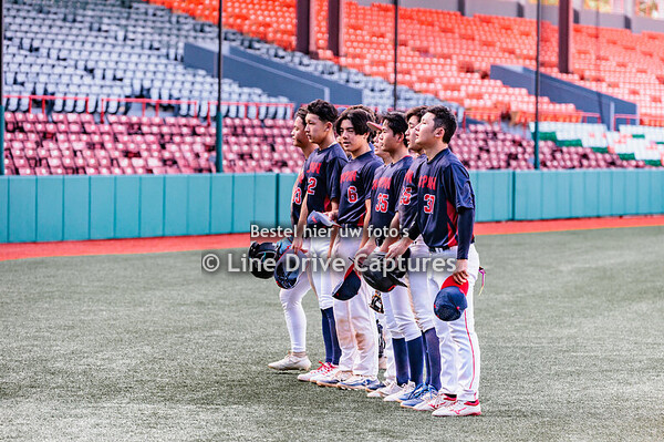 20250201 JP vs CA DIBAT